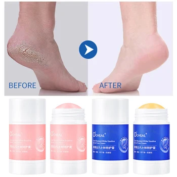 1PC Αντι Ρωγμή Λευκή Κρέμα Διαρκείας Ενυδατική Αντι Πάγωμα Hand Foot Care Cream Αφαίρεση Νεκρού Δέρματος Exfoliantes Προϊόντα Ομορφιάς