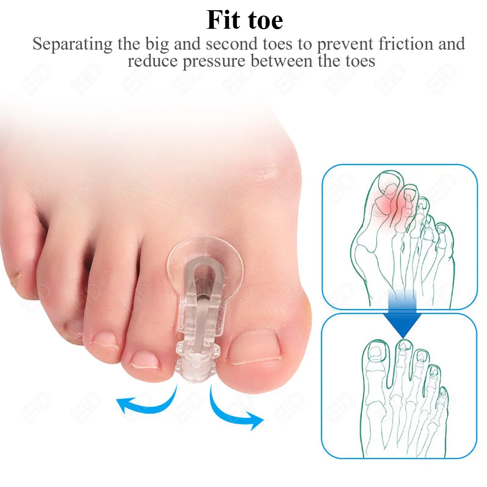 EiD Ορθοπεδικά Πόδι Μεγάλο Δάχτυλο Του Ποδιού Straightener Βλαισού Μεγάλου Δακτύλου Κάλο Διορθωτής Ορθωτικά Πέλματα Των Οστών Αντίχειρα Ρυθμιστής Διόρθωση Πεντικιούρ